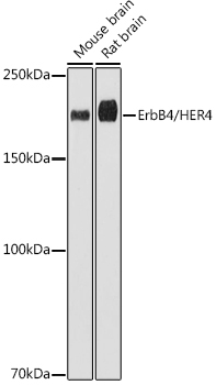 ErbB4/HER4 Rabbit Monoclonal Antibody