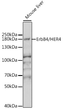 ErbB4/HER4 Rabbit Polyclonal Antibody