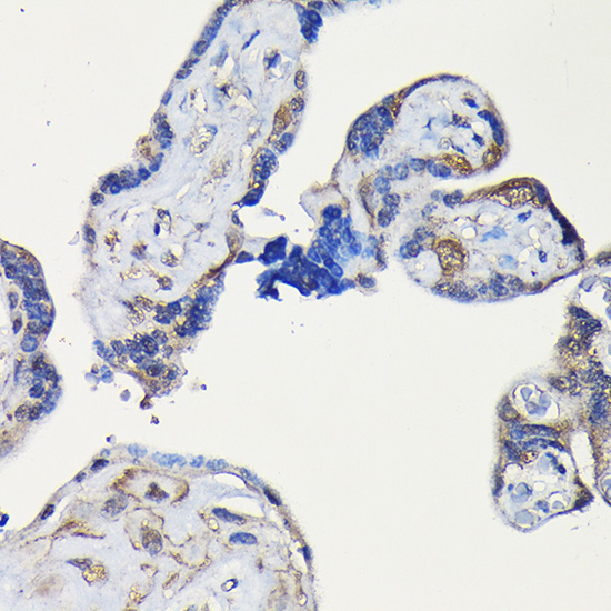 ErbB4/HER4 Rabbit Polyclonal Antibody - Image 2