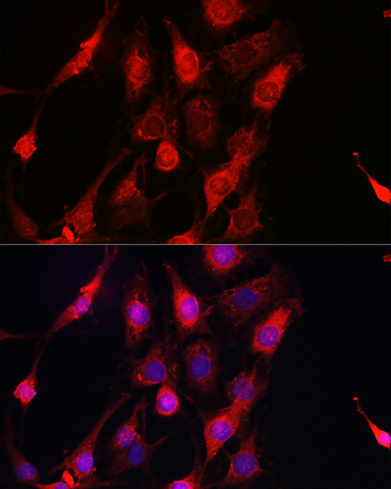 ErbB4/HER4 Rabbit Polyclonal Antibody - Image 3
