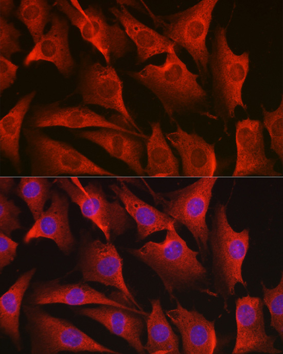 ErbB4/HER4 Rabbit Polyclonal Antibody - Image 4