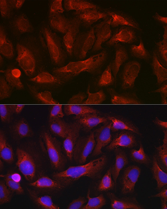 ErbB4/HER4 Rabbit Polyclonal Antibody - Image 5