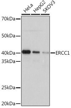 ERCC1 Rabbit Monoclonal Antibody