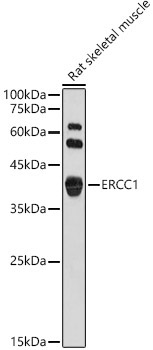 ERCC1 Rabbit Polyclonal Antibody