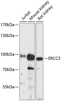 ERCC3 Rabbit Polyclonal Antibody