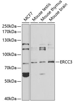 ERCC3 Rabbit Polyclonal Antibody