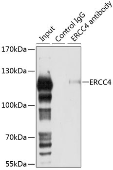 ERCC4 Rabbit Polyclonal Antibody - Image 2