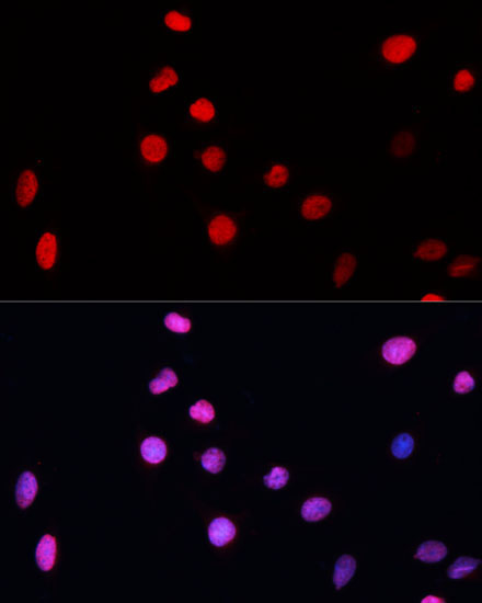 ERCC5 Rabbit Polyclonal Antibody