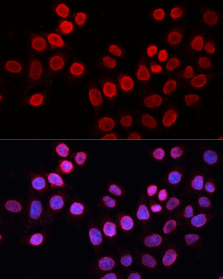 ERCC5 Rabbit Polyclonal Antibody - Image 2