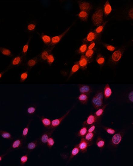 ERCC5 Rabbit Polyclonal Antibody - Image 3