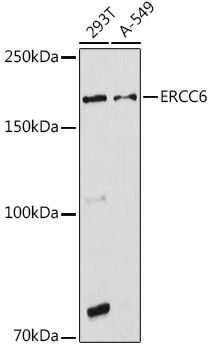 ERCC6 Rabbit Polyclonal Antibody - Image 2