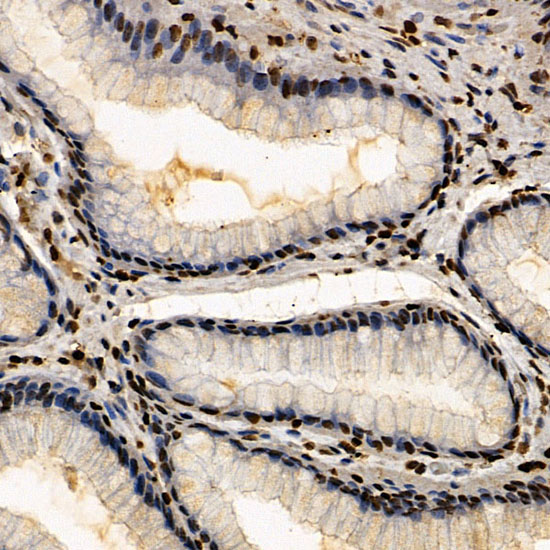 ERCC6 Rabbit Polyclonal Antibody - Image 3