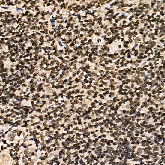 ERCC6 Rabbit Polyclonal Antibody - Image 4