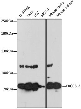 ERCC6L2 Rabbit Polyclonal Antibody