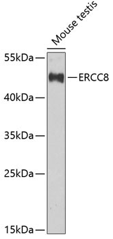 ERCC8 Rabbit Polyclonal Antibody