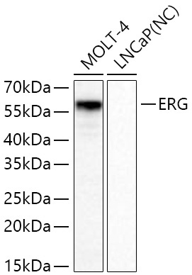ERG Rabbit Monoclonal Antibody