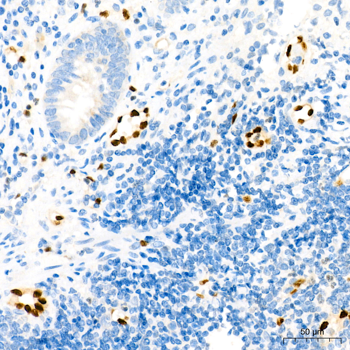 ERG Rabbit Monoclonal Antibody - Image 2