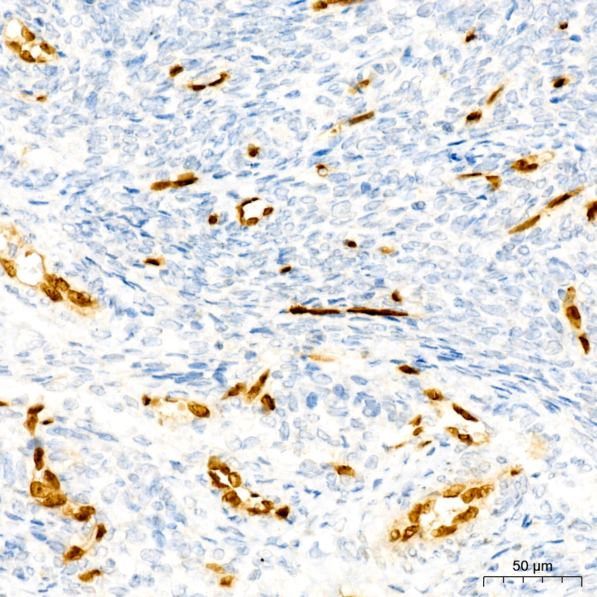 ERG Rabbit Monoclonal Antibody - Image 3
