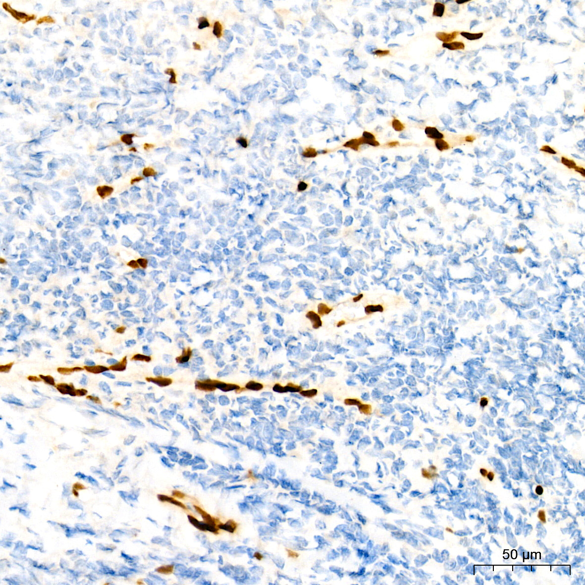 ERG Rabbit Monoclonal Antibody - Image 4