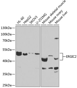 ERGIC2 Rabbit Polyclonal Antibody