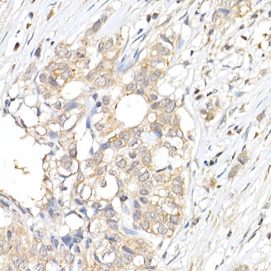 ERK1 / ERK2 Rabbit Polyclonal Antibody - Image 2