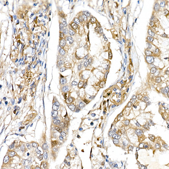 ERK1 / ERK2 Rabbit Polyclonal Antibody - Image 3