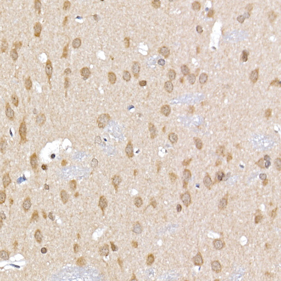 ERK1 / ERK2 Rabbit Polyclonal Antibody - Image 6