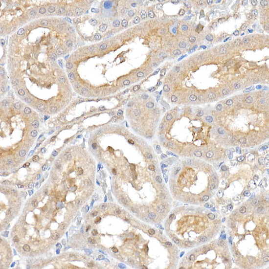 ERK1 / ERK2 Rabbit Polyclonal Antibody - Image 7
