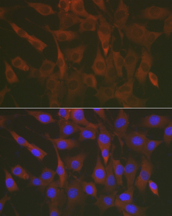 ERK1 / ERK2 Rabbit Polyclonal Antibody - Image 8