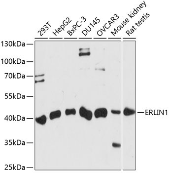 ERLIN1 Rabbit Polyclonal Antibody