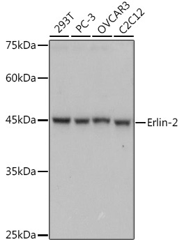 Erlin-2 Rabbit Monoclonal Antibody