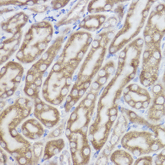 Erlin-2 Rabbit Monoclonal Antibody - Image 2