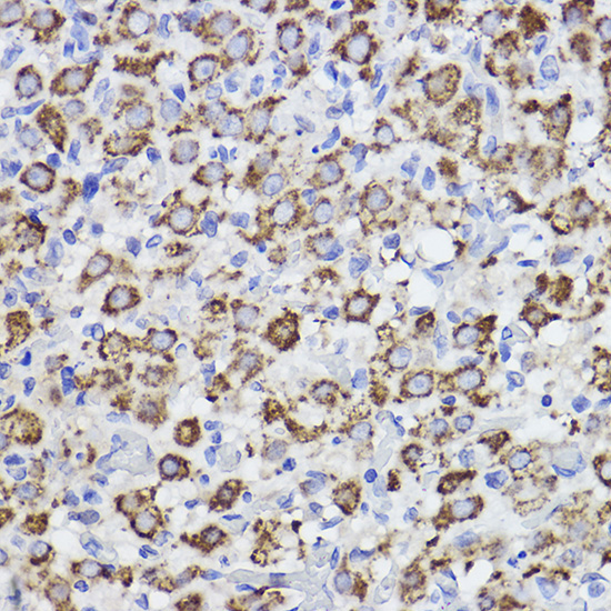 Erlin-2 Rabbit Monoclonal Antibody - Image 3