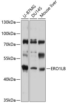 ERO1LB Rabbit Polyclonal Antibody
