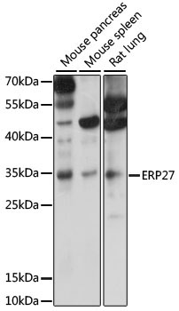 ERP27 Rabbit Polyclonal Antibody