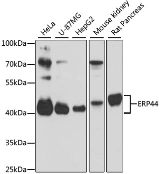 ERP44 Rabbit Polyclonal Antibody