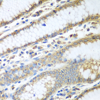 ERp57 Rabbit Polyclonal Antibody - Image 2