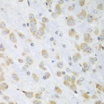 ERp57 Rabbit Polyclonal Antibody - Image 3