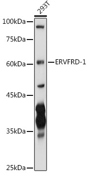 ERVFRD-1 Rabbit Polyclonal Antibody
