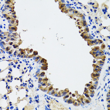 ESD Rabbit Polyclonal Antibody - Image 3