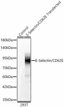 E-Selectin/CD62E Rabbit Polyclonal Antibody
