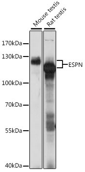 ESPN Rabbit Polyclonal Antibody