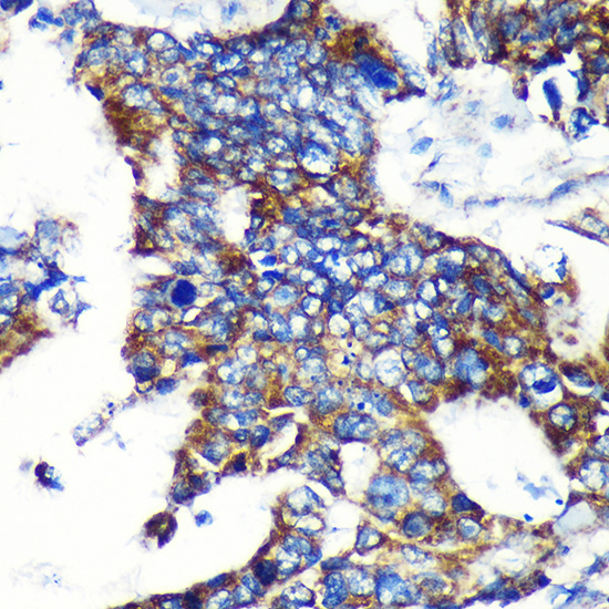 ESPN Rabbit Polyclonal Antibody - Image 2