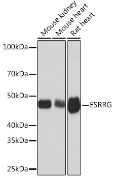 ESRRG Rabbit Monoclonal Antibody