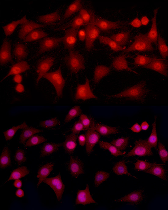 ESRAlpha Rabbit Monoclonal Antibody