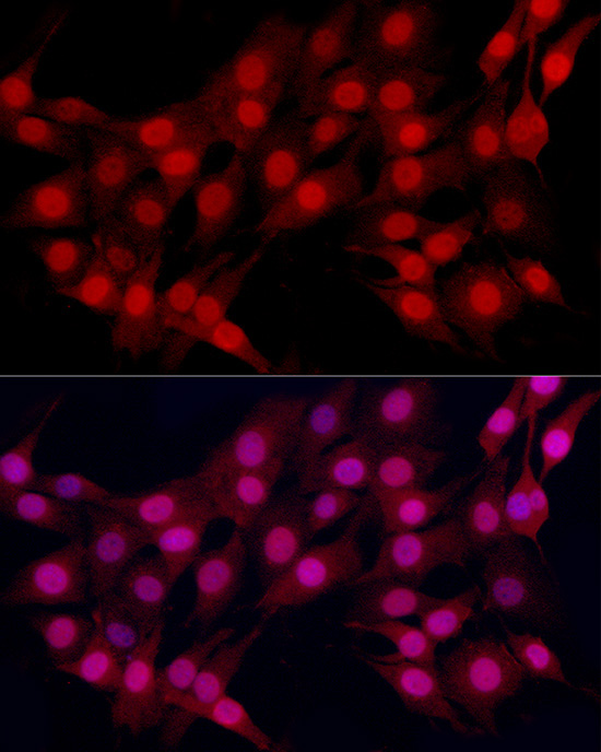ESRAlpha Rabbit Monoclonal Antibody - Image 2