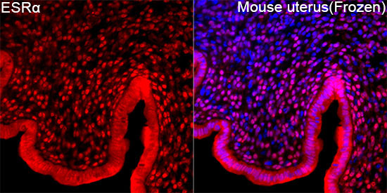 ESRAlpha Rabbit Polyclonal Antibody - Image 2
