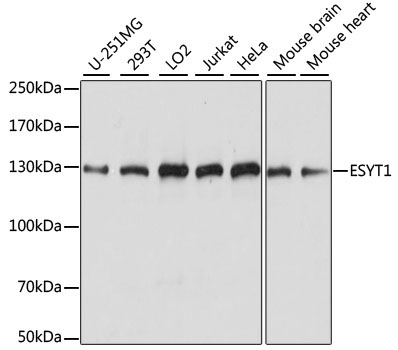 ESYT1 Rabbit Polyclonal Antibody