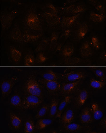 ESYT1 Rabbit Polyclonal Antibody - Image 2