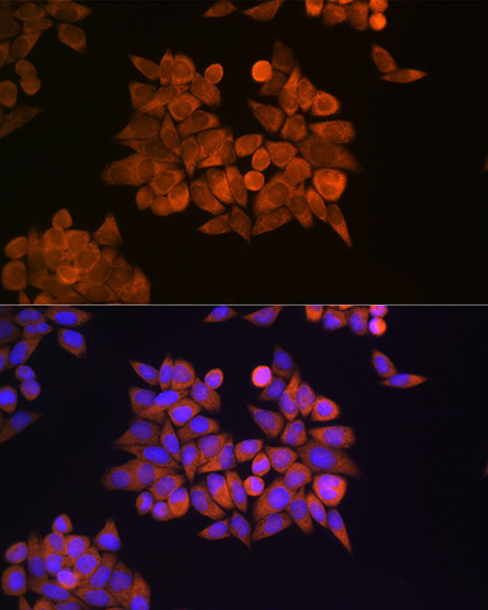 ETF1 Rabbit Polyclonal Antibody - Image 2